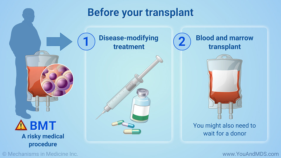Before your transplant