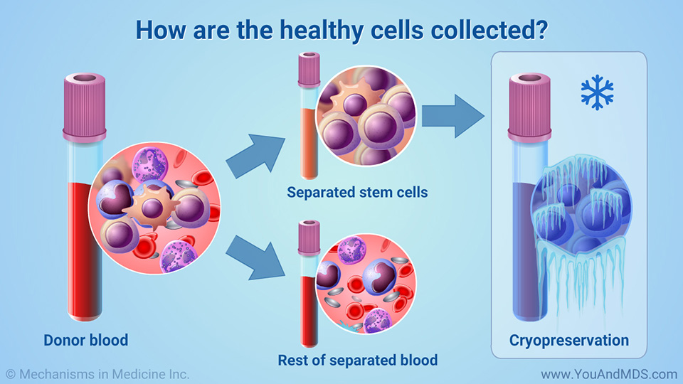How are the healthy cells collected?