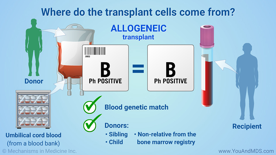 Where do the transplant cells come from?