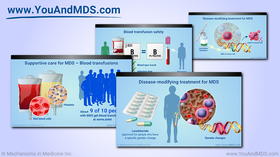 Management and Treatment of MDS