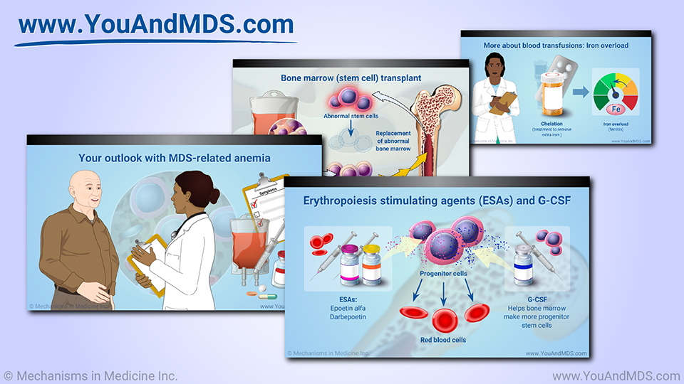 Slide Show - Managing and Treating MDS-related Anemia