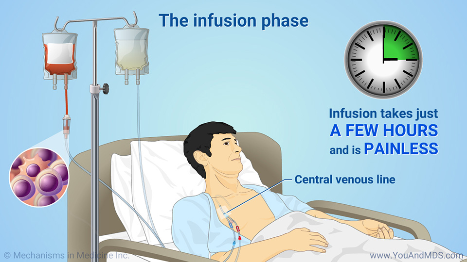 What to expect during the infusion