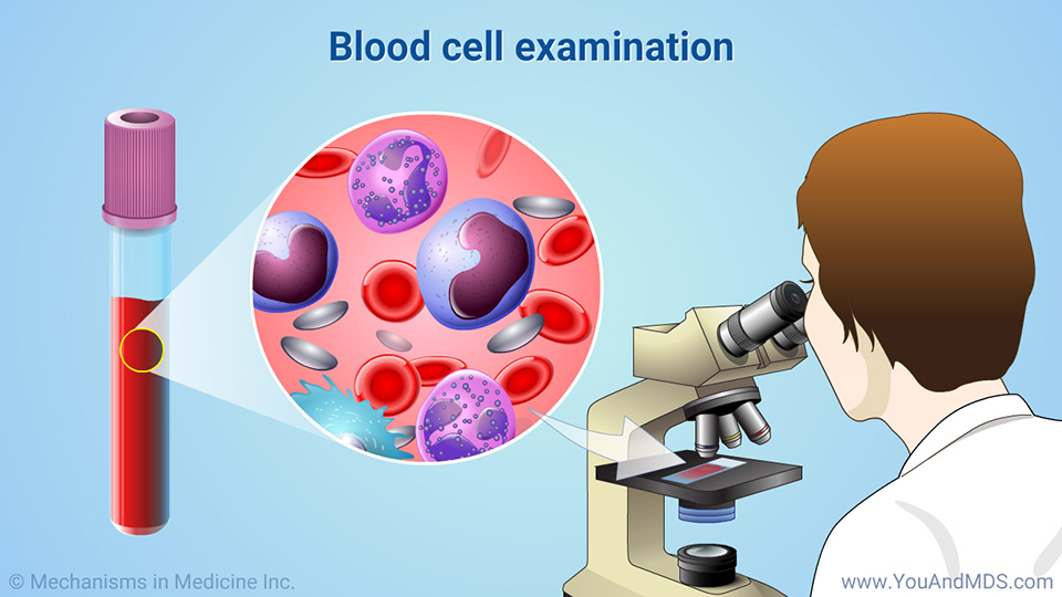 Blood cell examination