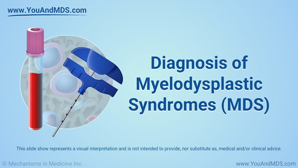 Diagnosis of Myelodysplastic Syndromes (MDS) 