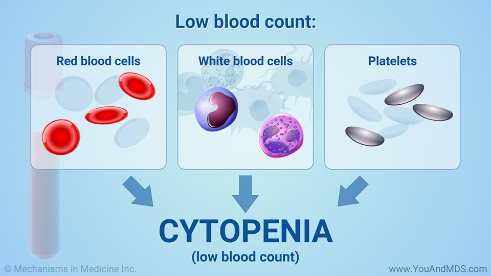 Low blood count: Cytopenia