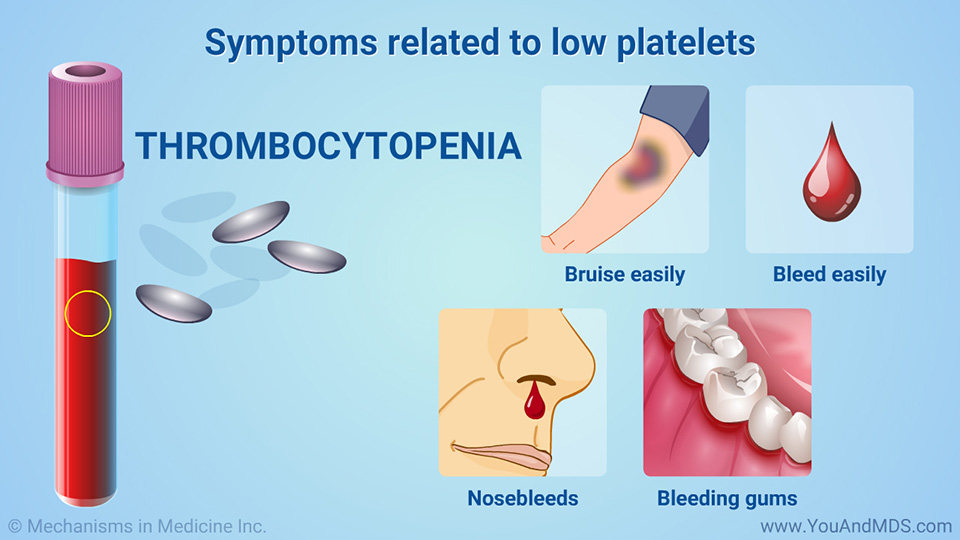 Symptoms related to low platelets