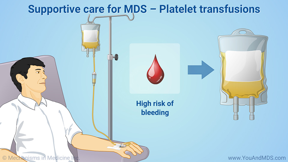 Supportive care for MDS – Platelet transfusions