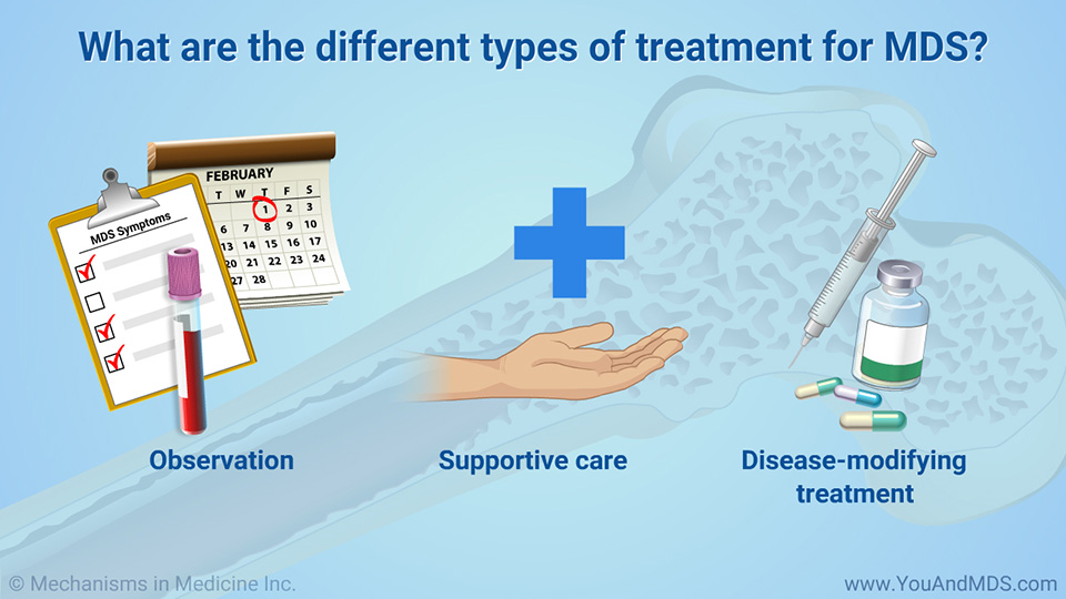 What are the different types of treatment for MDS?
