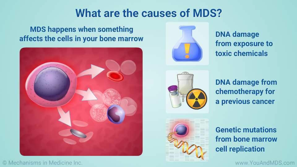 What are the causes of MDS?