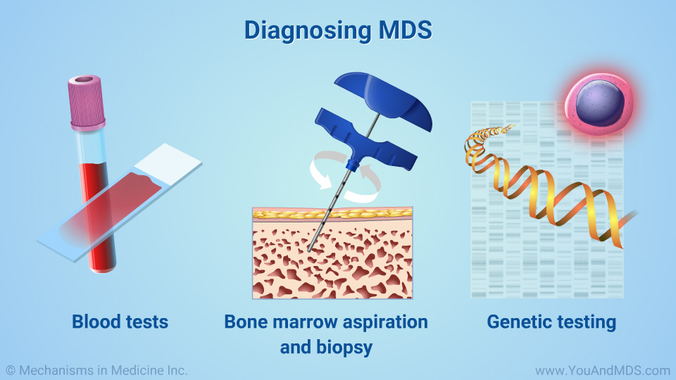 Diagnosing MDS 