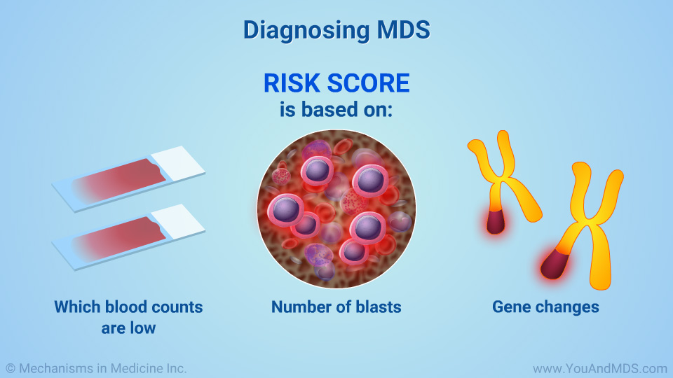 Diagnosing MDS
