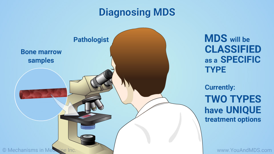 Diagnosing MDS