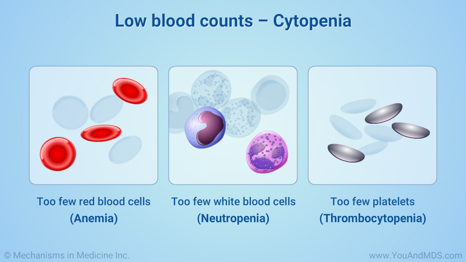 Low blood counts – Cytopenia