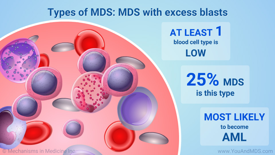 Types of MDS: MDS with excess blasts 