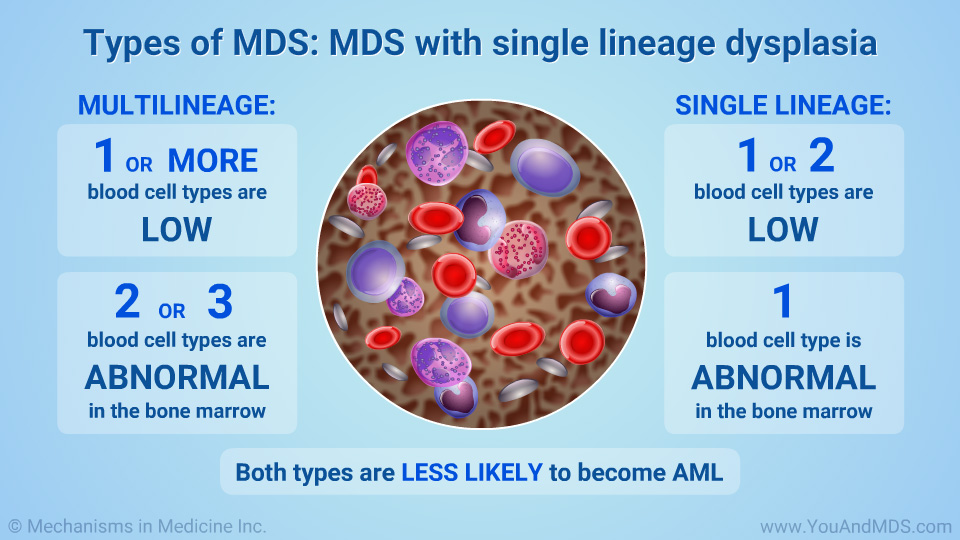 Types of MDS: Multilineage and single lineage dysplasia