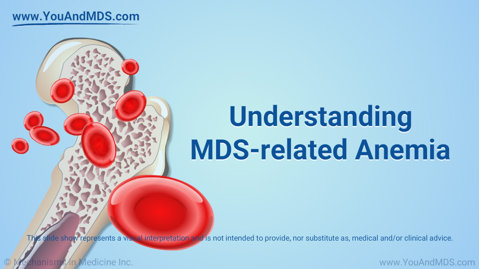 Understanding MDS-related Anemia