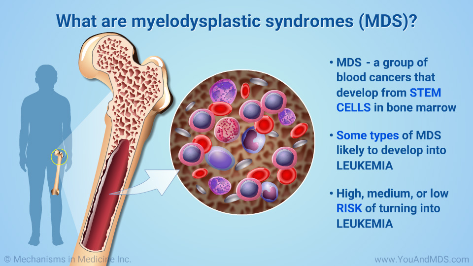 What are myelodysplastic syndromes (MDS)?