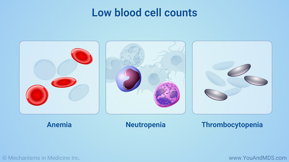 Low blood cell counts